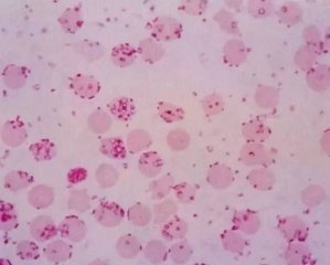 从流行病学、临床症状与诊断、防治措施等方面详解猪附红细胞体病